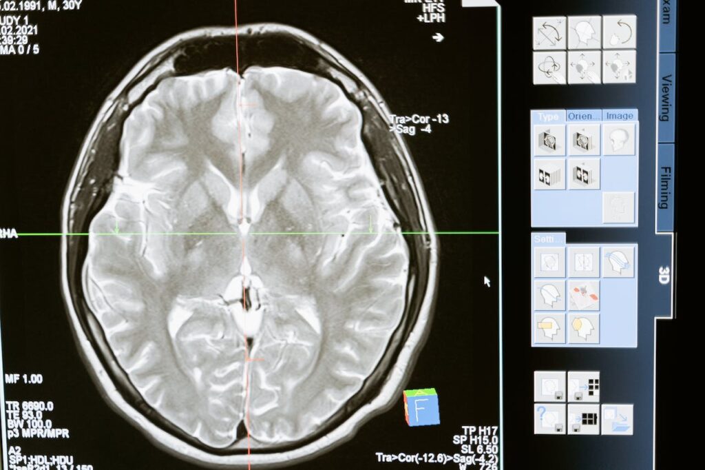 Darmiyan BrainSee FDA Approval for Alzheimer's Diagnosis